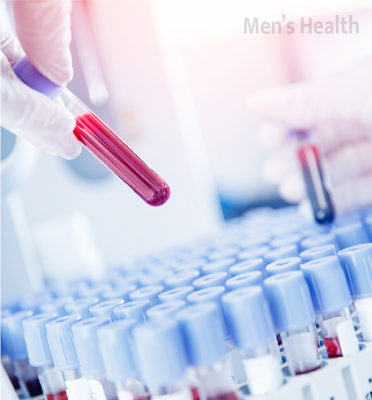 std test